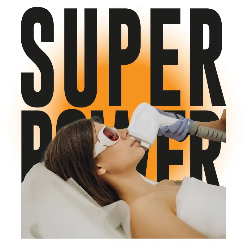 Epilazione Laser professionale